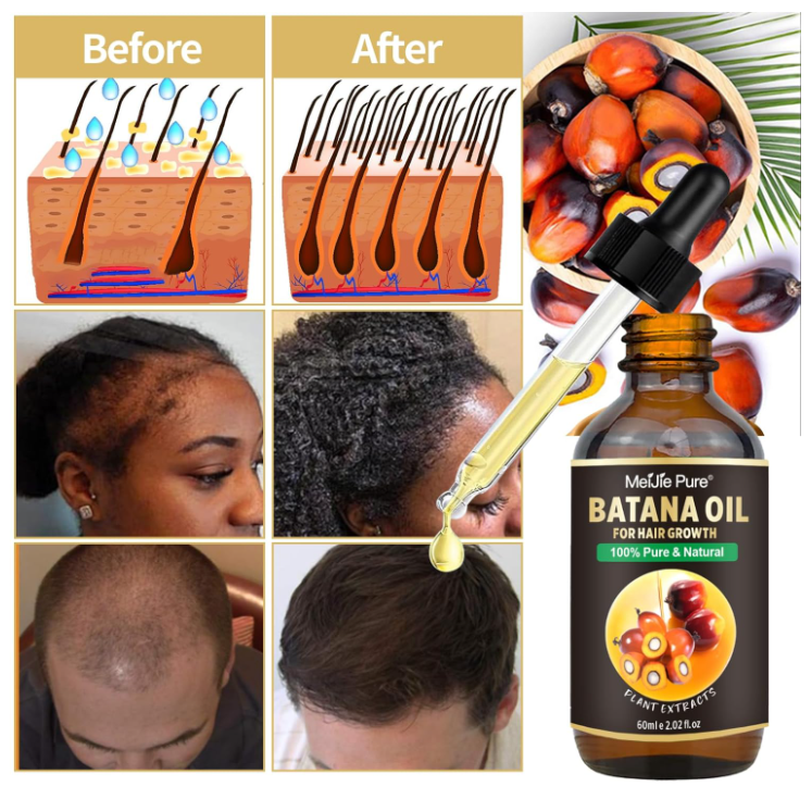 Batana Oil 4-Piece Hair Growth Set – Raw Oil, Mask, Lash Wand & Brow Brush